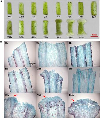 GhLBDs Promote Callus Initiation and Act as Selectable Markers to Increase Transformation Efficiency